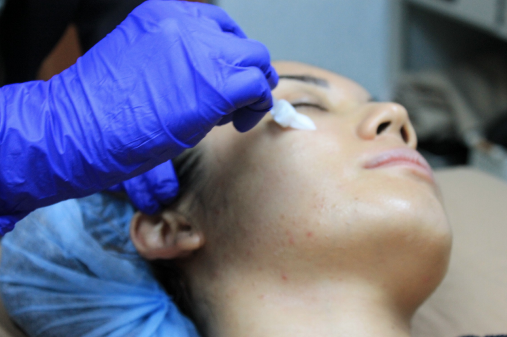 Skin peels can work wonders on some of the most frustrating complexion issues, from acne to uneven skin tone.