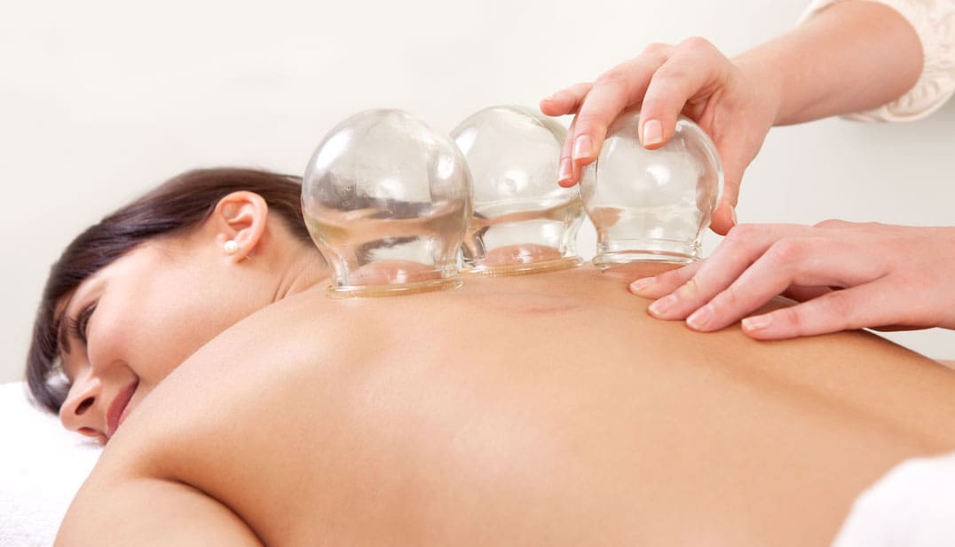 cupping-an-ancient-chinese-relaxation-practice-1076x616