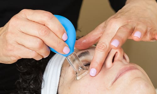 services-facial-cupping