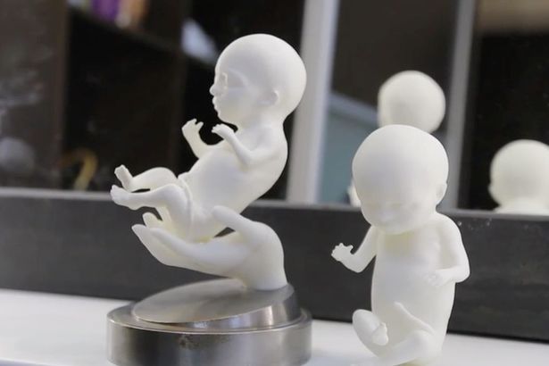 Expectant mothers can now print 3D models of their unborn child