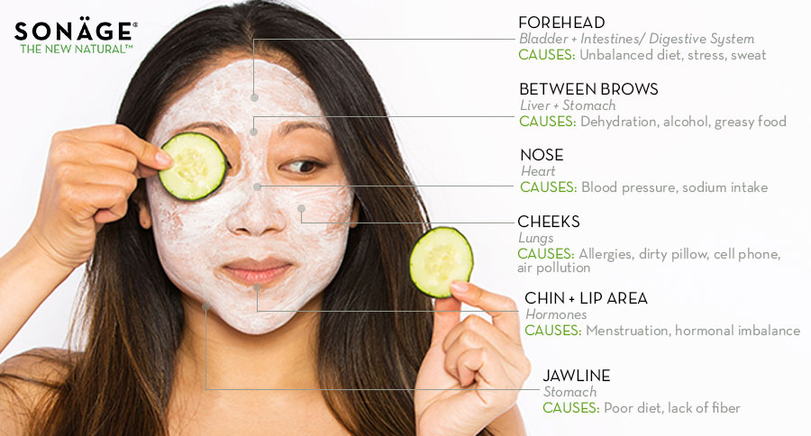 What causes breakouts on cheeks